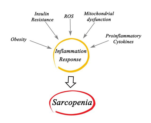 Sarcopenia obesidad muscualos aove covid19 oleo