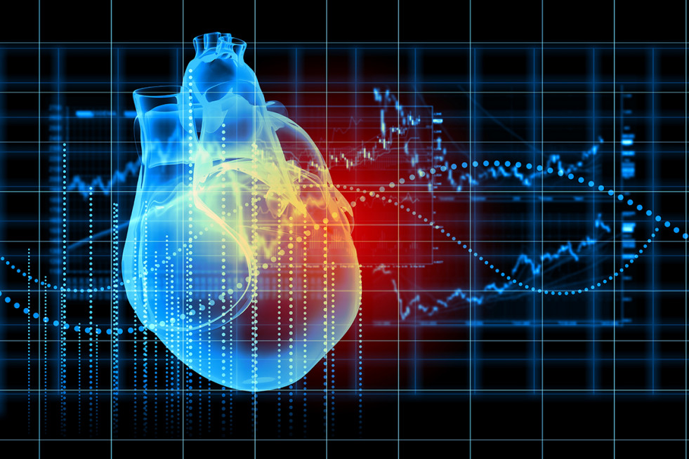 Enfermedades cardiovasculares aove estudio predimedplus oleo 200223